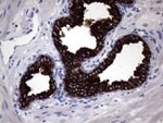 KRT18 Antibody in Immunohistochemistry (Paraffin) (IHC (P))