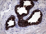 KRT18 Antibody in Immunohistochemistry (Paraffin) (IHC (P))