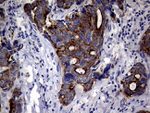 KRT18 Antibody in Immunohistochemistry (Paraffin) (IHC (P))