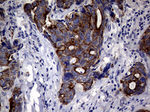 KRT18 Antibody in Immunohistochemistry (Paraffin) (IHC (P))