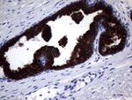 KRT18 Antibody in Immunohistochemistry (Paraffin) (IHC (P))