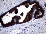 KRT18 Antibody in Immunohistochemistry (Paraffin) (IHC (P))