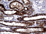 KRT18 Antibody in Immunohistochemistry (Paraffin) (IHC (P))