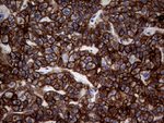 KRT18 Antibody in Immunohistochemistry (Paraffin) (IHC (P))