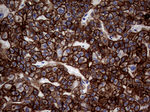 KRT18 Antibody in Immunohistochemistry (Paraffin) (IHC (P))