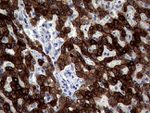 KRT18 Antibody in Immunohistochemistry (Paraffin) (IHC (P))