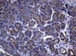 KRT18 Antibody in Immunohistochemistry (Paraffin) (IHC (P))