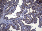 KRT18 Antibody in Immunohistochemistry (Paraffin) (IHC (P))