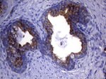 KRT18 Antibody in Immunohistochemistry (Paraffin) (IHC (P))