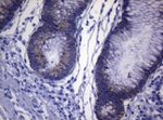 KRT18 Antibody in Immunohistochemistry (Paraffin) (IHC (P))
