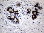 KRT18 Antibody in Immunohistochemistry (Paraffin) (IHC (P))