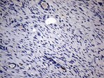 KRT18 Antibody in Immunohistochemistry (Paraffin) (IHC (P))