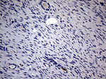 KRT18 Antibody in Immunohistochemistry (Paraffin) (IHC (P))
