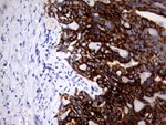 KRT18 Antibody in Immunohistochemistry (Paraffin) (IHC (P))