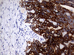 KRT18 Antibody in Immunohistochemistry (Paraffin) (IHC (P))