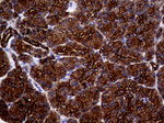 KRT18 Antibody in Immunohistochemistry (Paraffin) (IHC (P))