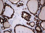 KRT18 Antibody in Immunohistochemistry (Paraffin) (IHC (P))