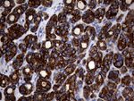 KRT18 Antibody in Immunohistochemistry (Paraffin) (IHC (P))