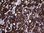 KRT18 Antibody in Immunohistochemistry (Paraffin) (IHC (P))