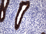 KRT18 Antibody in Immunohistochemistry (Paraffin) (IHC (P))