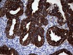 KRT18 Antibody in Immunohistochemistry (Paraffin) (IHC (P))