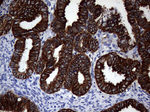 KRT18 Antibody in Immunohistochemistry (Paraffin) (IHC (P))