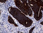 KRT18 Antibody in Immunohistochemistry (Paraffin) (IHC (P))