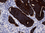 KRT18 Antibody in Immunohistochemistry (Paraffin) (IHC (P))