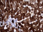 KRT18 Antibody in Immunohistochemistry (Paraffin) (IHC (P))
