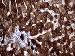 KRT18 Antibody in Immunohistochemistry (Paraffin) (IHC (P))