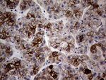 KRT18 Antibody in Immunohistochemistry (Paraffin) (IHC (P))