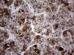 KRT18 Antibody in Immunohistochemistry (Paraffin) (IHC (P))