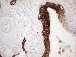 KRT18 Antibody in Immunohistochemistry (Paraffin) (IHC (P))