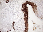 KRT18 Antibody in Immunohistochemistry (Paraffin) (IHC (P))