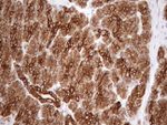 KRT18 Antibody in Immunohistochemistry (Paraffin) (IHC (P))