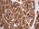 KRT18 Antibody in Immunohistochemistry (Paraffin) (IHC (P))