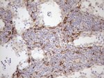 KRT18 Antibody in Immunohistochemistry (Paraffin) (IHC (P))