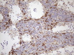 KRT18 Antibody in Immunohistochemistry (Paraffin) (IHC (P))