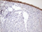 KRT18 Antibody in Immunohistochemistry (Paraffin) (IHC (P))