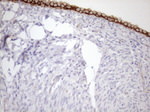 KRT18 Antibody in Immunohistochemistry (Paraffin) (IHC (P))