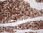 KRT18 Antibody in Immunohistochemistry (Paraffin) (IHC (P))