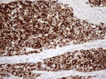 KRT18 Antibody in Immunohistochemistry (Paraffin) (IHC (P))