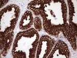 KRT18 Antibody in Immunohistochemistry (Paraffin) (IHC (P))