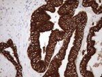 KRT18 Antibody in Immunohistochemistry (Paraffin) (IHC (P))