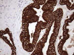 KRT18 Antibody in Immunohistochemistry (Paraffin) (IHC (P))