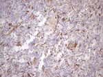 KRT18 Antibody in Immunohistochemistry (Paraffin) (IHC (P))
