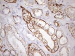 KRT18 Antibody in Immunohistochemistry (Paraffin) (IHC (P))