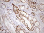 KRT18 Antibody in Immunohistochemistry (Paraffin) (IHC (P))