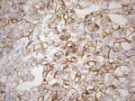KRT18 Antibody in Immunohistochemistry (Paraffin) (IHC (P))