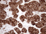 KRT18 Antibody in Immunohistochemistry (Paraffin) (IHC (P))